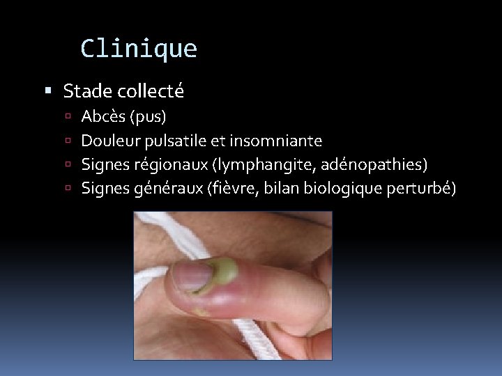 Clinique Stade collecté Abcès (pus) Douleur pulsatile et insomniante Signes régionaux (lymphangite, adénopathies) Signes