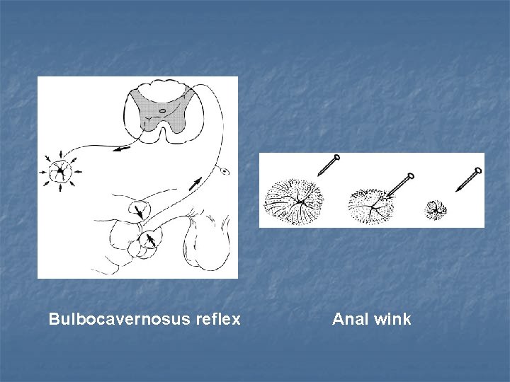 Bulbocavernosus reflex Anal wink 