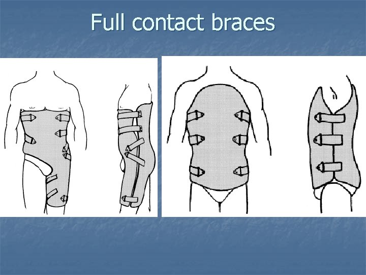 Full contact braces 