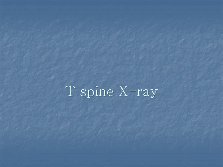 T spine X-ray 
