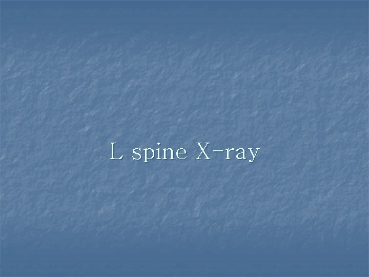L spine X-ray 