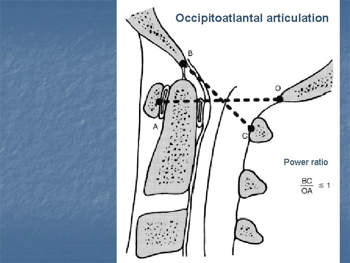 Occipitoatlantal articulation Power ratio 