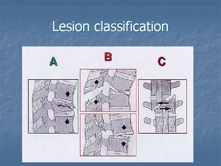 Lesion classification 