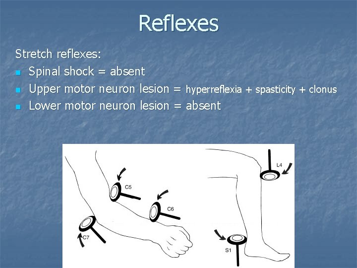Reflexes Stretch reflexes: n Spinal shock = absent n Upper motor neuron lesion =