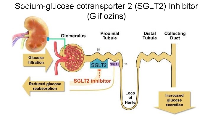 Sodium-glucose cotransporter 2 (SGLT 2) Inhibitor (Gliflozins) 