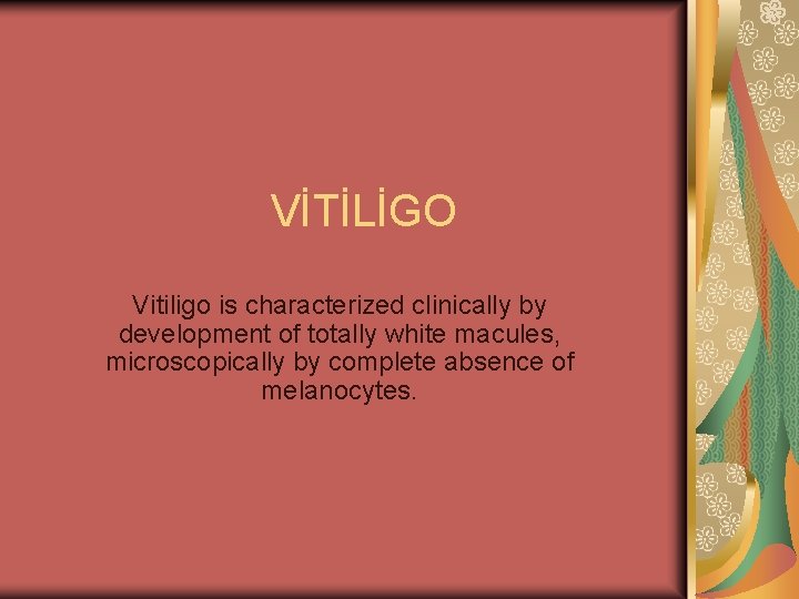 VİTİLİGO Vitiligo is characterized clinically by development of totally white macules, microscopically by complete