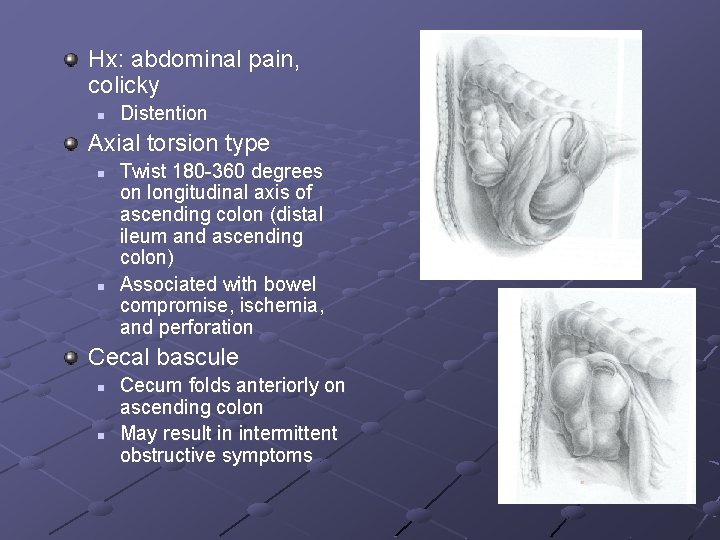 Hx: abdominal pain, colicky n Distention Axial torsion type n n Twist 180 -360 Hx: abdominal pain, colicky n Distention Axial torsion type n n Twist 180 -360
