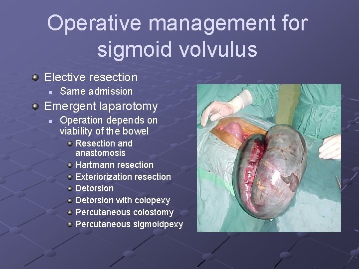 Operative management for sigmoid volvulus Elective resection n Same admission Emergent laparotomy n Operation Operative management for sigmoid volvulus Elective resection n Same admission Emergent laparotomy n Operation