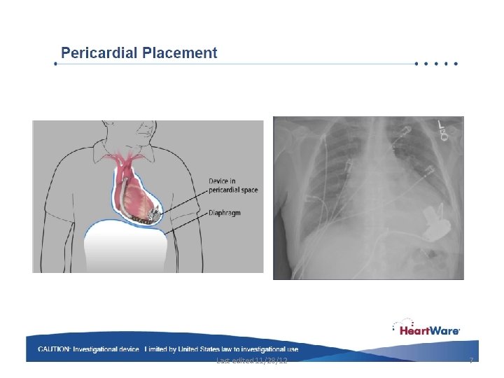 Last edited 11/28/12 7 Last edited 11/28/12 7