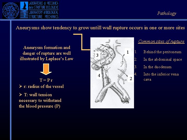 Pathology Aneurysms show tendency to grow untill wall rupture occurs in one or more