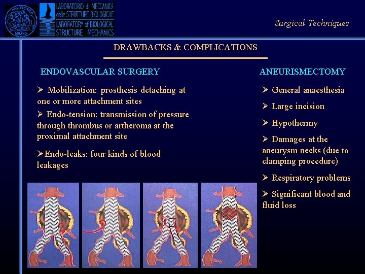 Surgical Techniques DRAWBACKS & COMPLICATIONS ENDOVASCULAR SURGERY Ø Mobilization: prosthesis detaching at one or