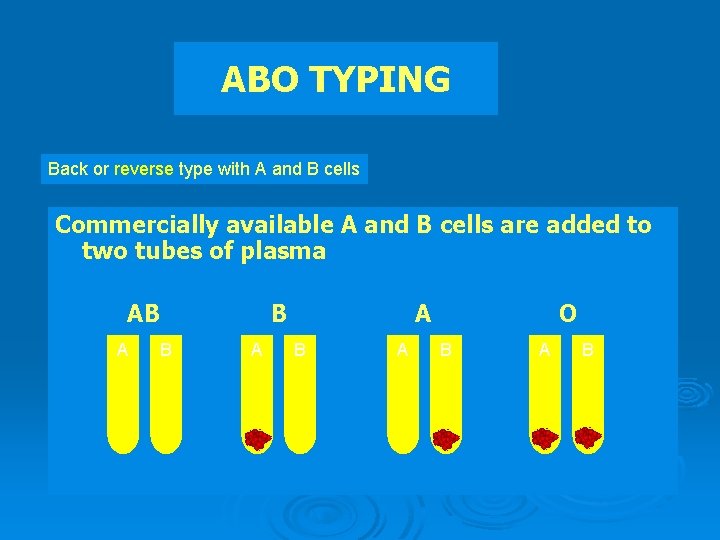 ABO TYPING Back or reverse type with A and B cells Commercially available A