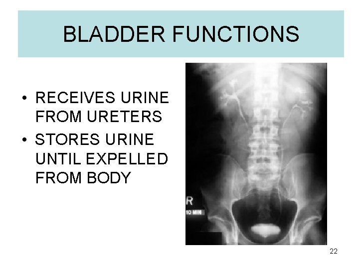 BLADDER FUNCTIONS • RECEIVES URINE FROM URETERS • STORES URINE UNTIL EXPELLED FROM BODY