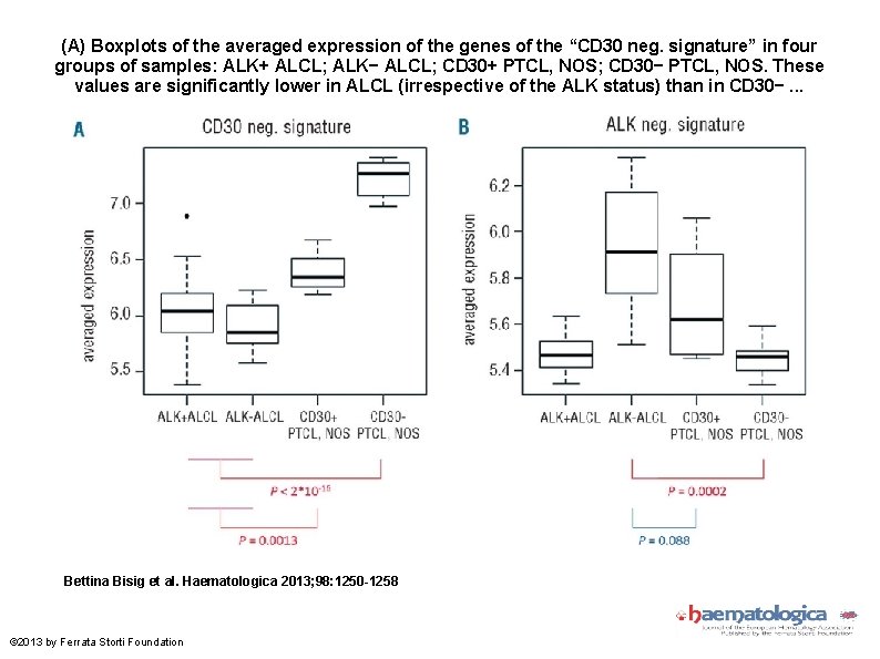 (A) Boxplots of the averaged expression of the genes of the “CD 30 neg.