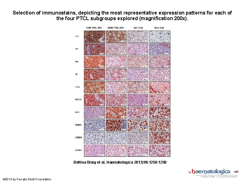 Selection of immunostains, depicting the most representative expression patterns for each of the four