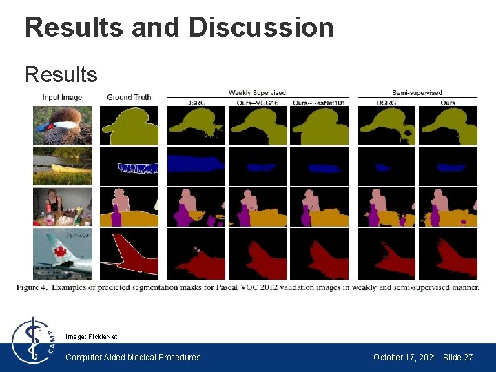 Results and Discussion Results Image: Fickle. Net Computer Aided Medical Procedures October 17, 2021