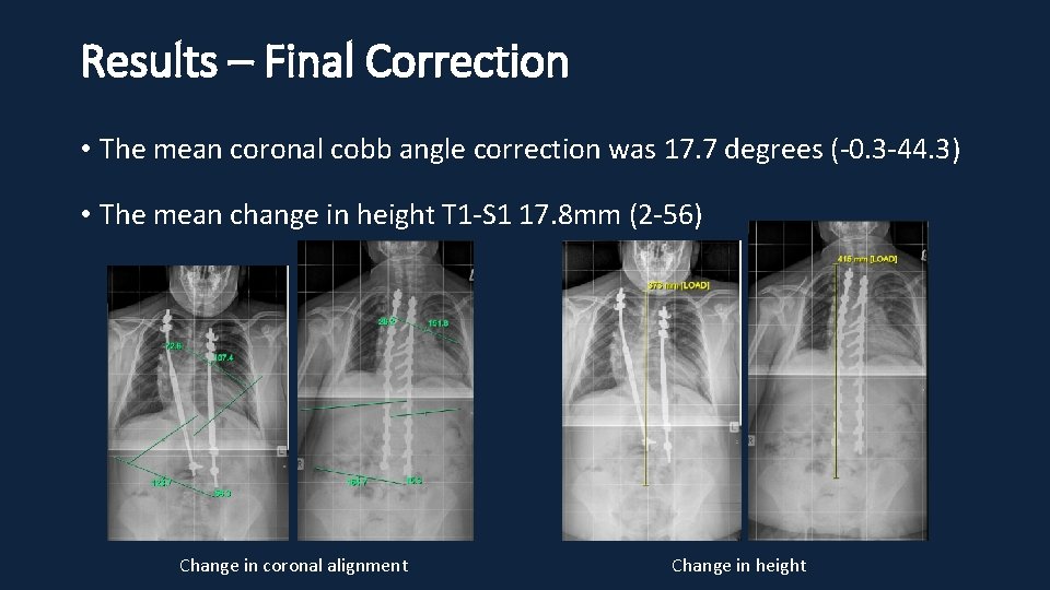 Results – Final Correction • The mean coronal cobb angle correction was 17. 7