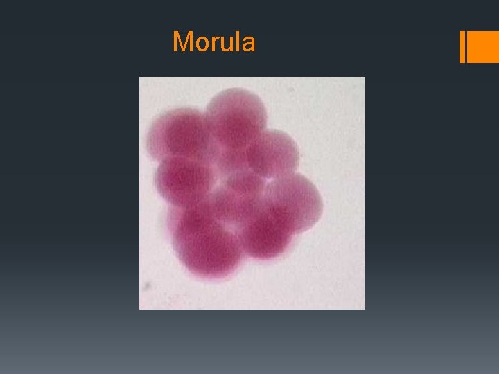Morula 