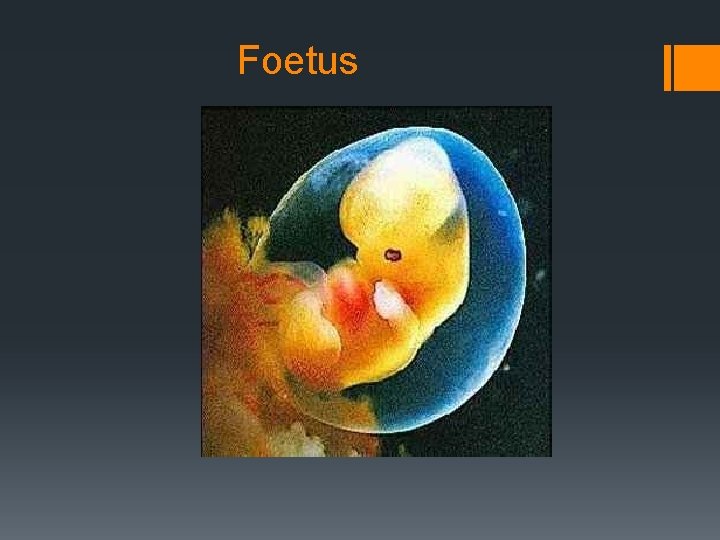 Foetus 