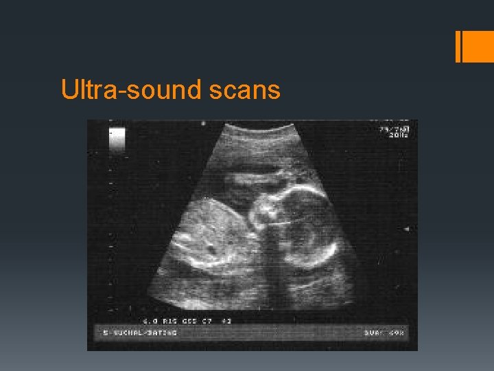 Ultra-sound scans 