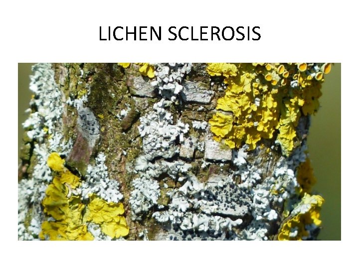 LICHEN SCLEROSIS LICHEN SCLEROSIS