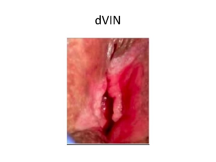 d. VIN d. VIN