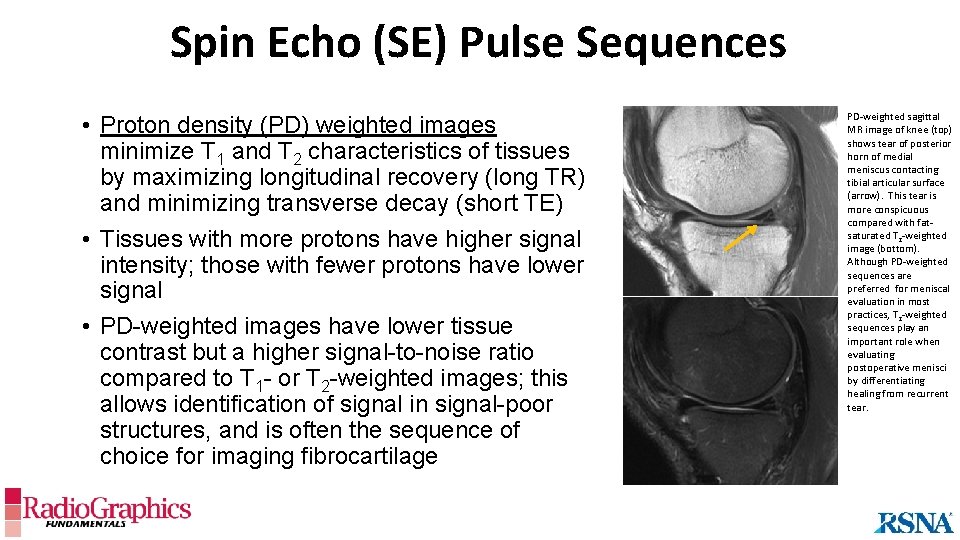 Spin Echo (SE) Pulse Sequences • Proton density (PD) weighted images minimize T 1