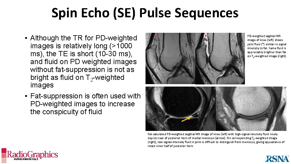 Spin Echo (SE) Pulse Sequences • Although the TR for PD-weighted images is relatively