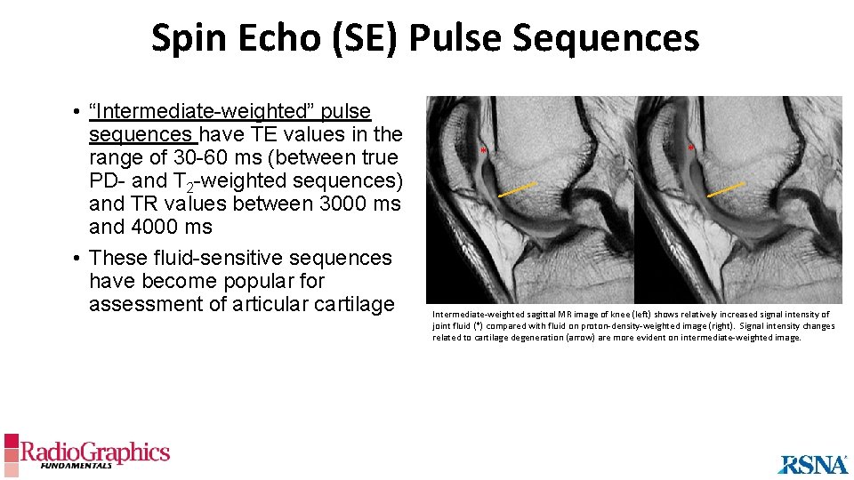 Spin Echo (SE) Pulse Sequences • “Intermediate-weighted” pulse sequences have TE values in the
