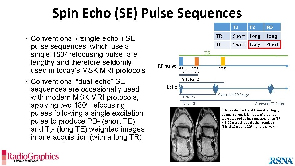 Spin Echo (SE) Pulse Sequences T 1 • Conventional (“single-echo”) SE pulse sequences, which