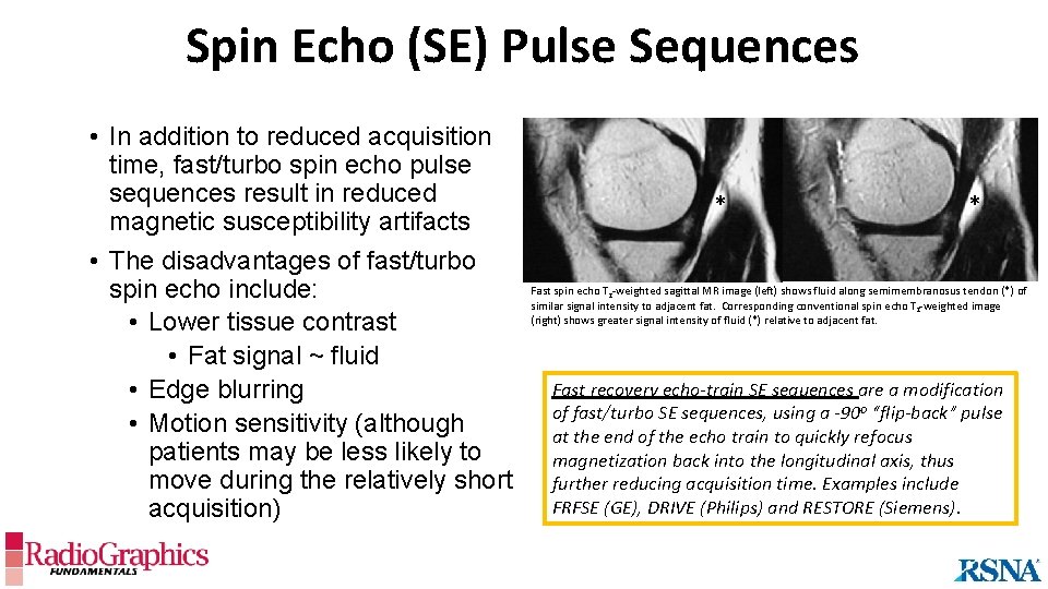 Spin Echo (SE) Pulse Sequences • In addition to reduced acquisition time, fast/turbo spin