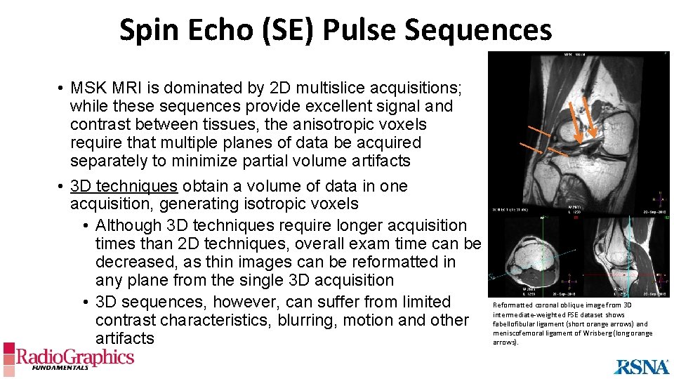 Spin Echo (SE) Pulse Sequences • MSK MRI is dominated by 2 D multislice