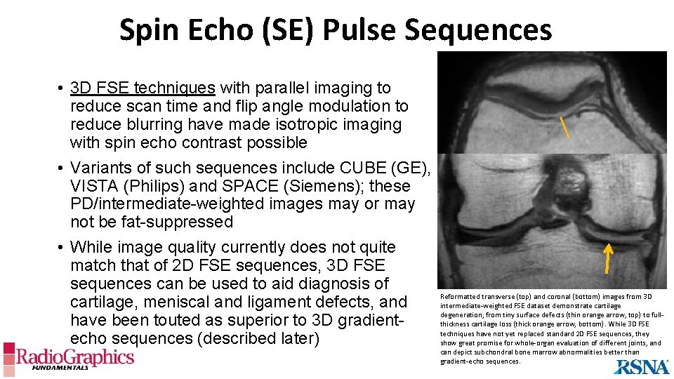 Spin Echo (SE) Pulse Sequences • 3 D FSE techniques with parallel imaging to
