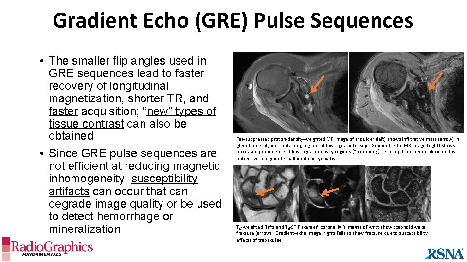 Gradient Echo (GRE) Pulse Sequences • The smaller flip angles used in GRE sequences