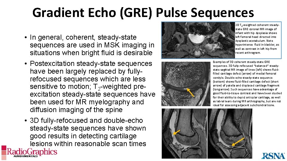 Gradient Echo (GRE) Pulse Sequences • In general, coherent, steady-state sequences are used in