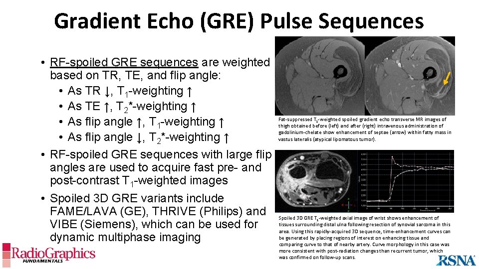 Gradient Echo (GRE) Pulse Sequences • RF-spoiled GRE sequences are weighted based on TR,