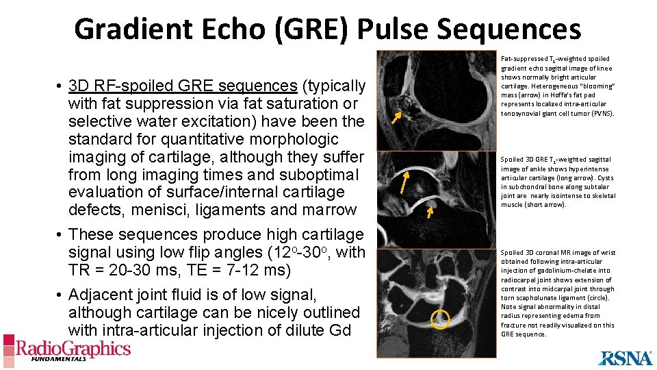 Gradient Echo (GRE) Pulse Sequences • 3 D RF-spoiled GRE sequences (typically with fat
