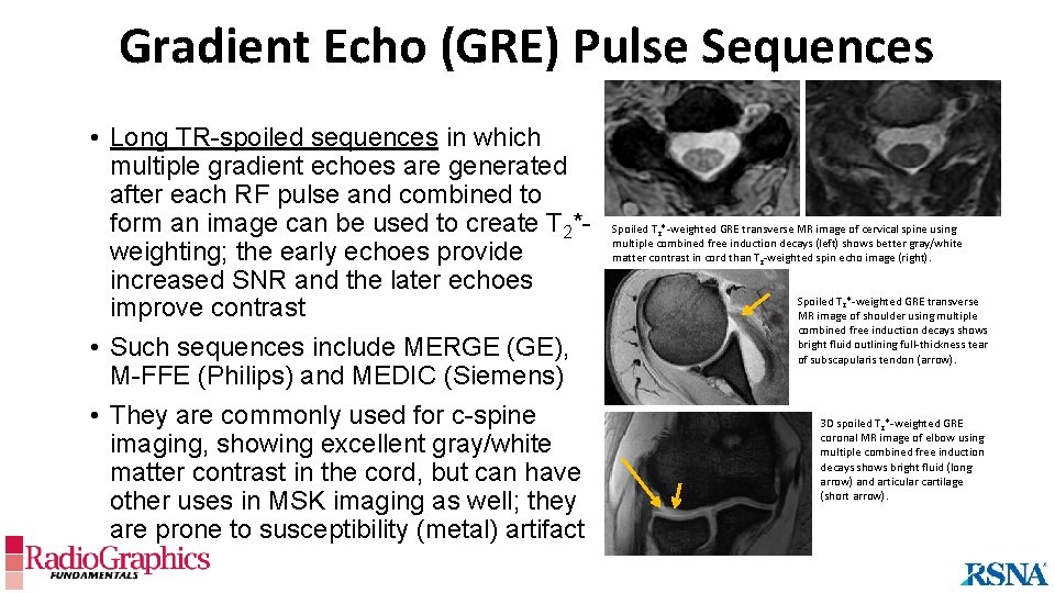 Gradient Echo (GRE) Pulse Sequences • Long TR-spoiled sequences in which multiple gradient echoes