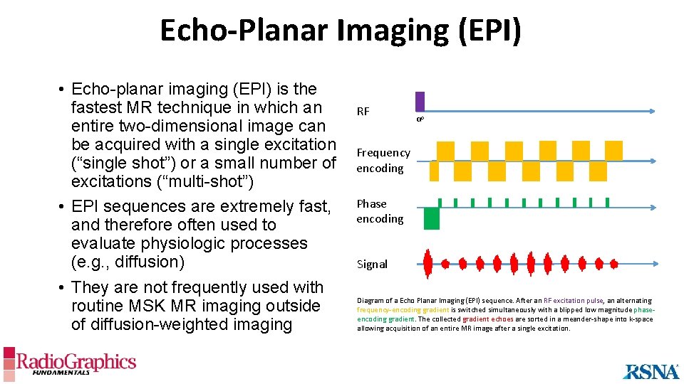 Echo-Planar Imaging (EPI) • Echo-planar imaging (EPI) is the fastest MR technique in which