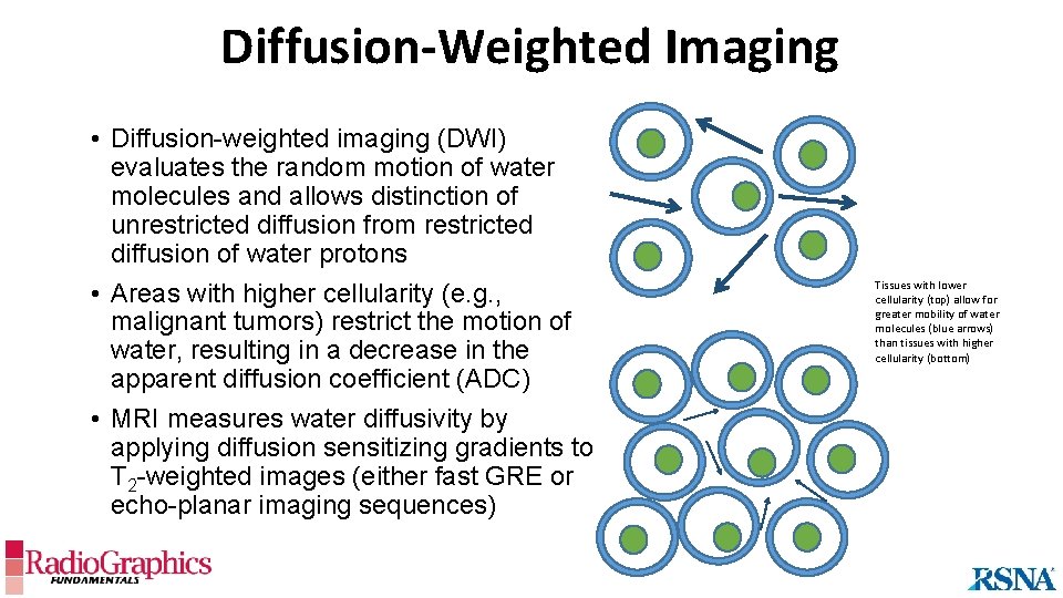 Diffusion-Weighted Imaging • Diffusion-weighted imaging (DWI) evaluates the random motion of water molecules and