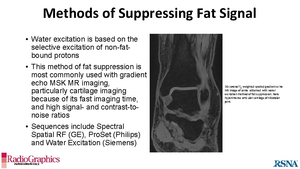 Methods of Suppressing Fat Signal • Water excitation is based on the selective excitation
