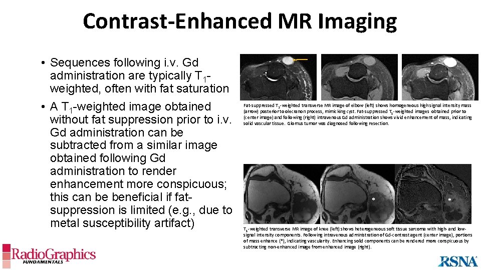 Contrast-Enhanced MR Imaging • Sequences following i. v. Gd administration are typically T 1