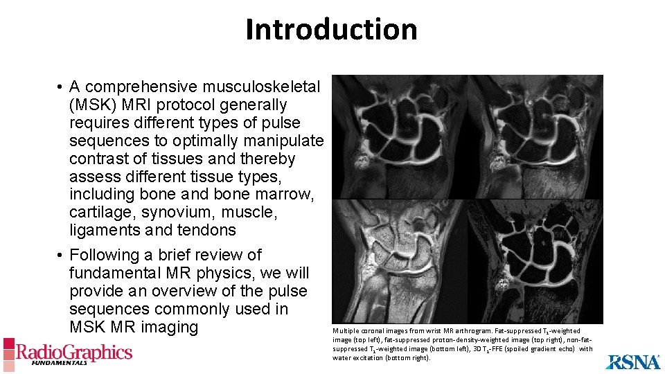 Introduction • A comprehensive musculoskeletal (MSK) MRI protocol generally requires different types of pulse