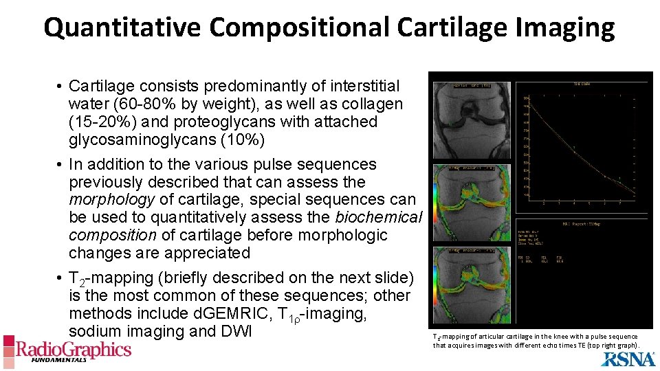 Quantitative Compositional Cartilage Imaging • Cartilage consists predominantly of interstitial water (60 -80% by