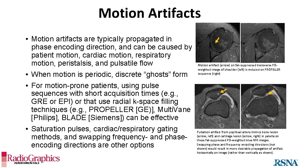 Motion Artifacts • Motion artifacts are typically propagated in phase encoding direction, and can