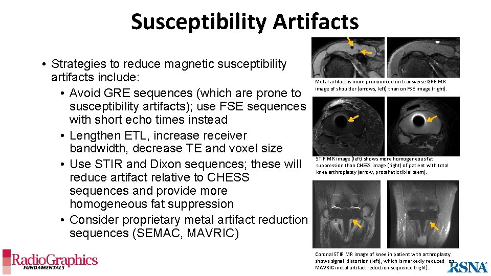 Susceptibility Artifacts • Strategies to reduce magnetic susceptibility artifacts include: • Avoid GRE sequences