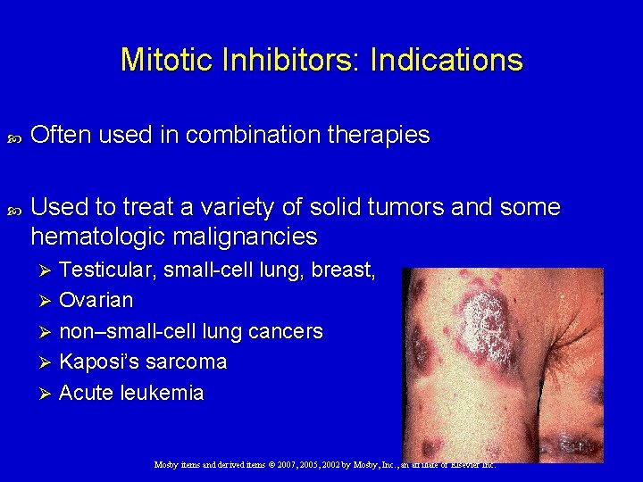 Mitotic Inhibitors: Indications Often used in combination therapies Used to treat a variety of