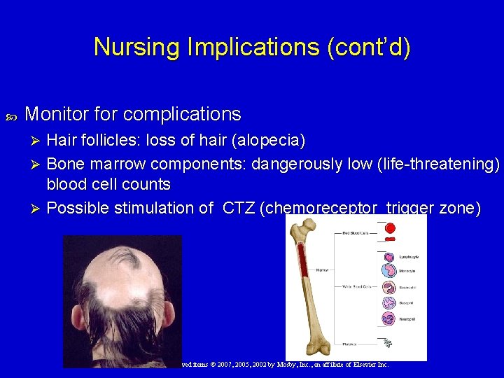 Nursing Implications (cont’d) Monitor for complications Hair follicles: loss of hair (alopecia) Ø Bone