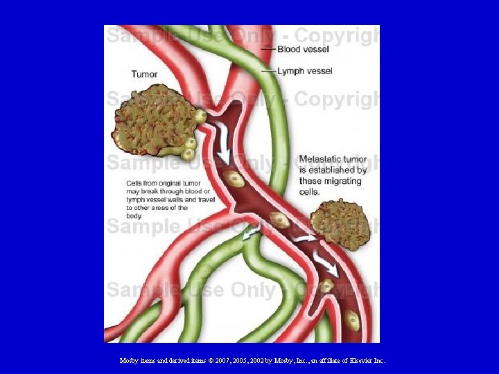 Mosby items and derived items © 2007, 2005, 2002 by Mosby, Inc. , an