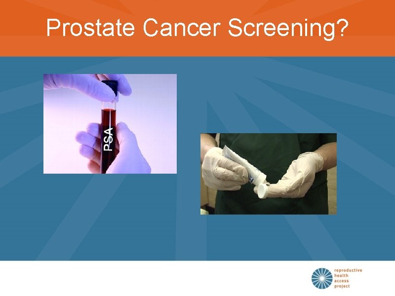 Prostate Cancer Screening? 
